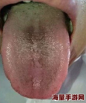 舌头探洞水好多怎么办这可能是由于口腔结构或唾液分泌过多引起的生理反应