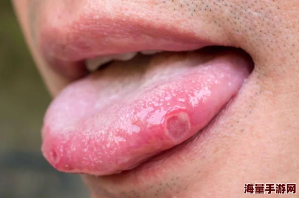 舌头探洞水好多怎么办这可能是由于口腔结构或唾液分泌过多引起的生理反应
