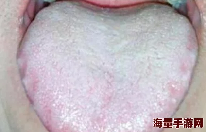 舌头探洞水好多怎么办这可能是由于口腔结构或唾液分泌过多引起的生理反应